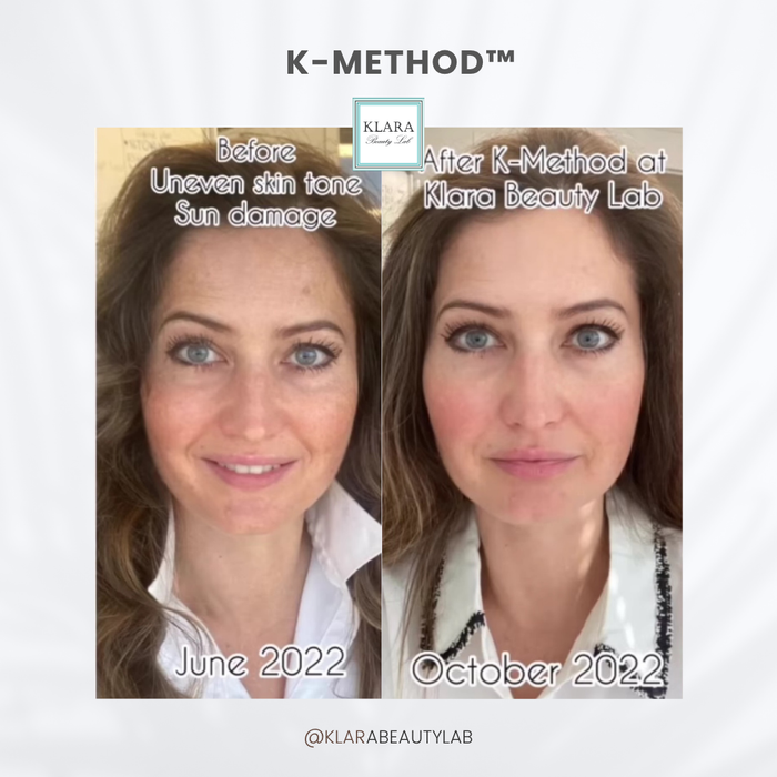 K-METHOD™