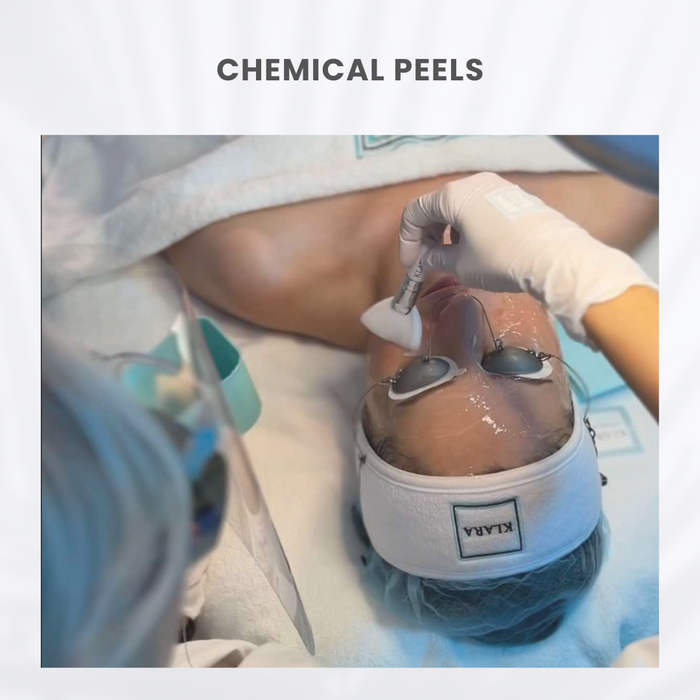 CHEMICAL PEELS
