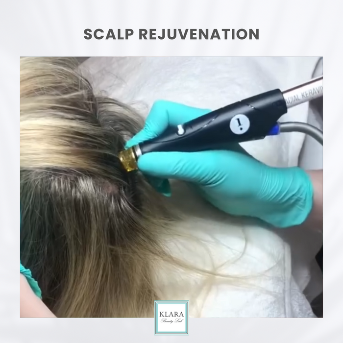 SCALP REJUVENATION
