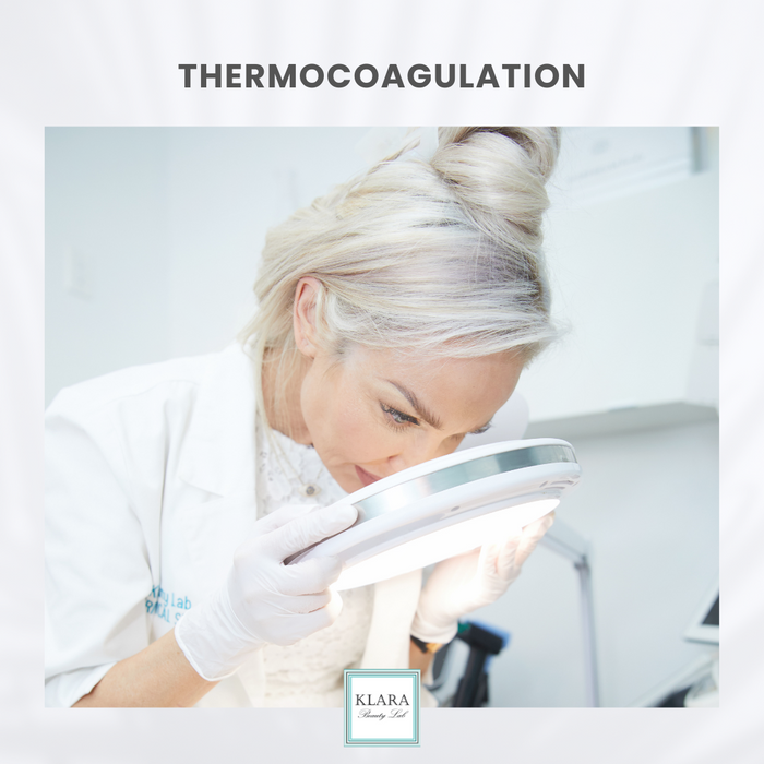 THERMOCOAGULATION