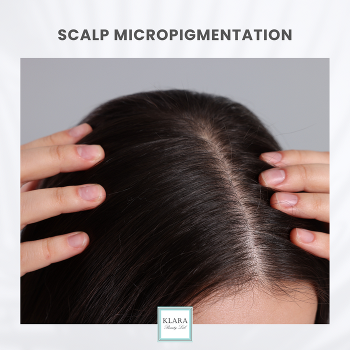 SCALP MICROPIGMENTATION